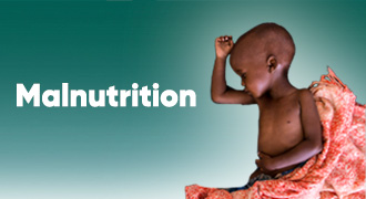Malnutrition